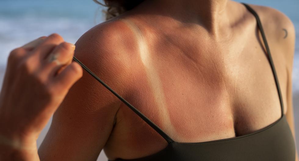 "Ya sea en una cama de bronceado o al sol, ese brillo 'saludable' que estás obteniendo es en realidad evidencia de que la radiación ultravioleta está dañando tu piel".