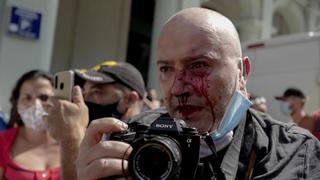 Protestas en Cuba: la policía agrede a fotógrafo de la agencia AP que cubría manifestaciones en La Habana