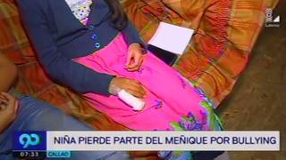 Callao: niña víctima de bullying perdió parte de un dedo en colegio