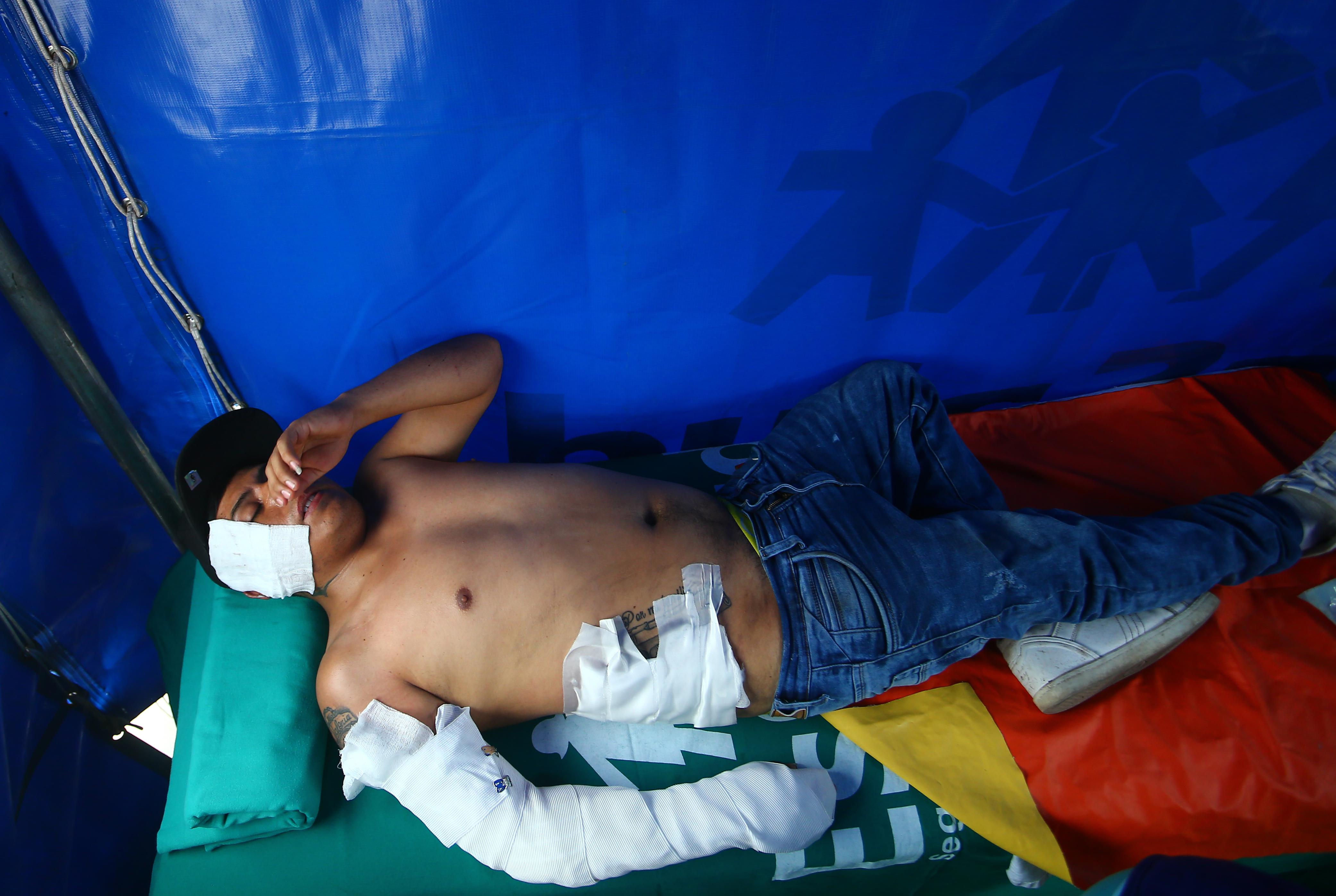 Javier García sufrió quemaduras de segundo grando en el brazo derecho y quemaduras de primer grado en el rostro. (Foto: Gonzalo Córdova/GEC)