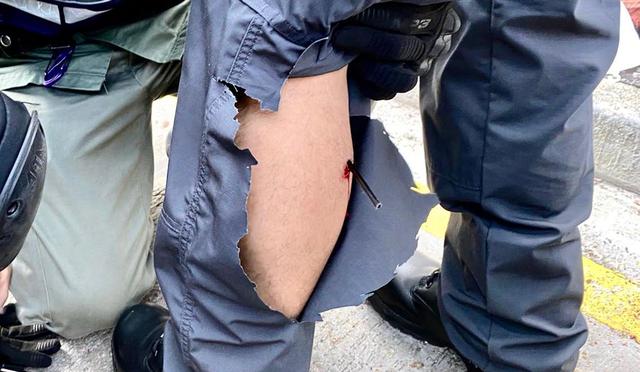 Toma cercana de la flecha incrustada en un policía que repelía las protestas en Hong Kong. (Foto: Twitter @hkpoliceforce)