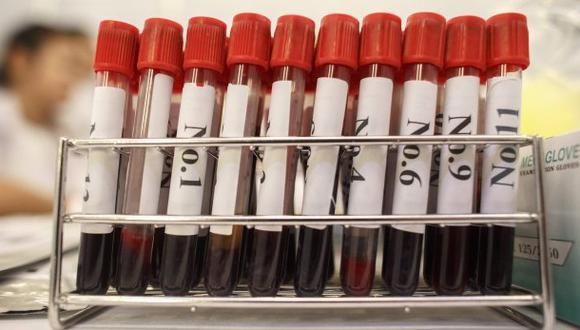 ¿Por qué tenemos distintos tipos de sangre?