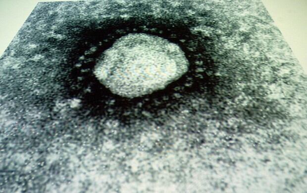 Una vista microscópica del coronavirus proyectada en una pantalla durante una conferencia de prensa sobre los nuevos hallazgos del virus del SARS en el Genome Institute de Singapur en mayo de 2003 (Foto: AFP)