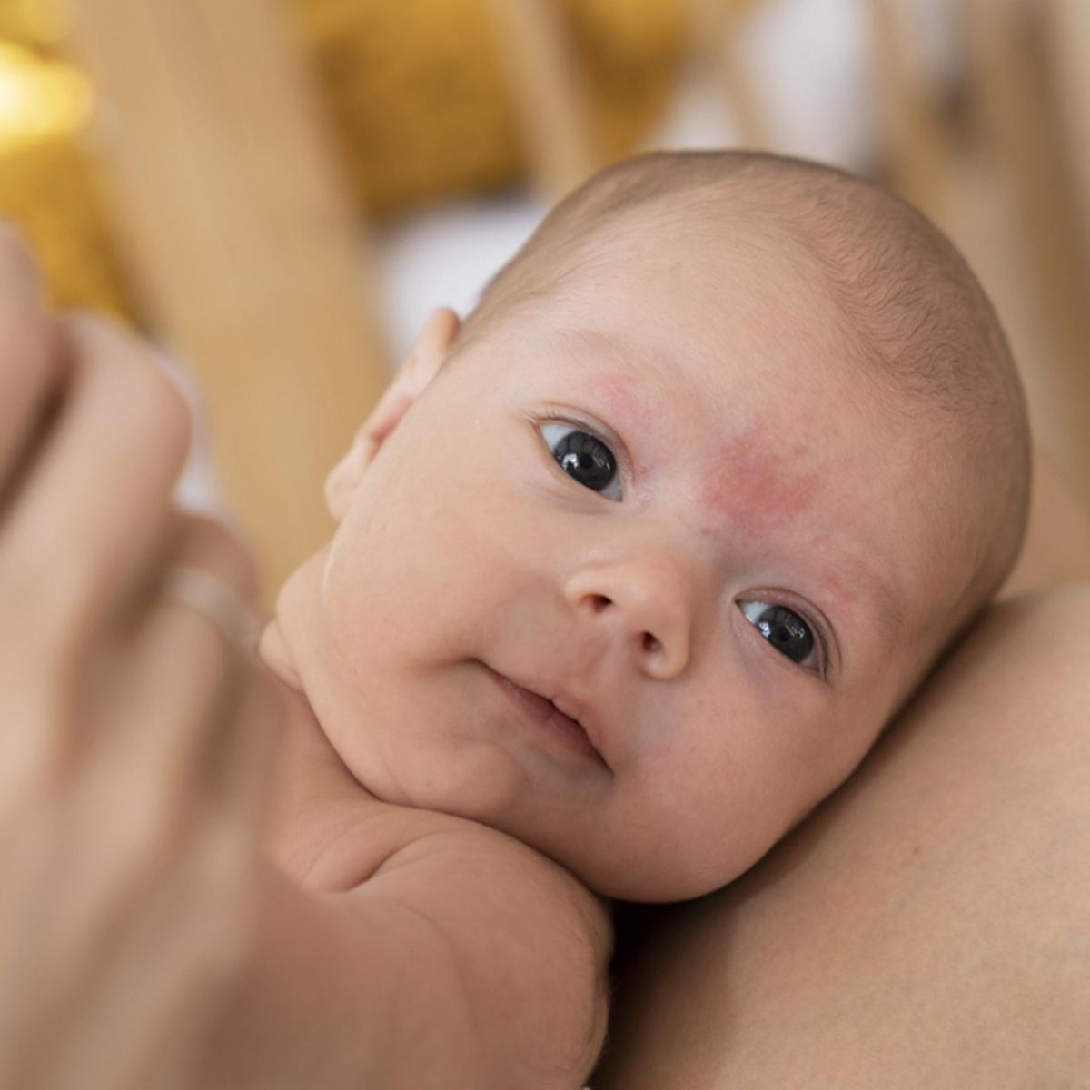 Costra láctea en bebés: Consejos para el adecuado manejo de la piel  sensible, HOGAR-FAMILIA