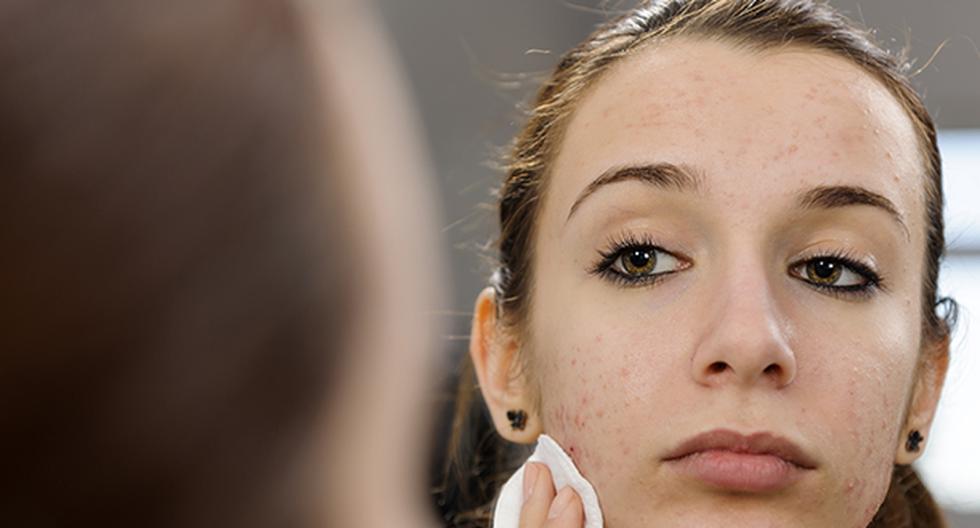 Conoce las señales de que eres alérgica en el maquillaje. (Foto: IStock)