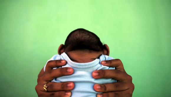&quot;Una microcefalia puede no ser evidente en el nacimiento sino desarrollarse m&aacute;s tarde con anormalidades cerebrales subyacentes&quot;, dice el nuevo estudio. (Foto: Reuters)