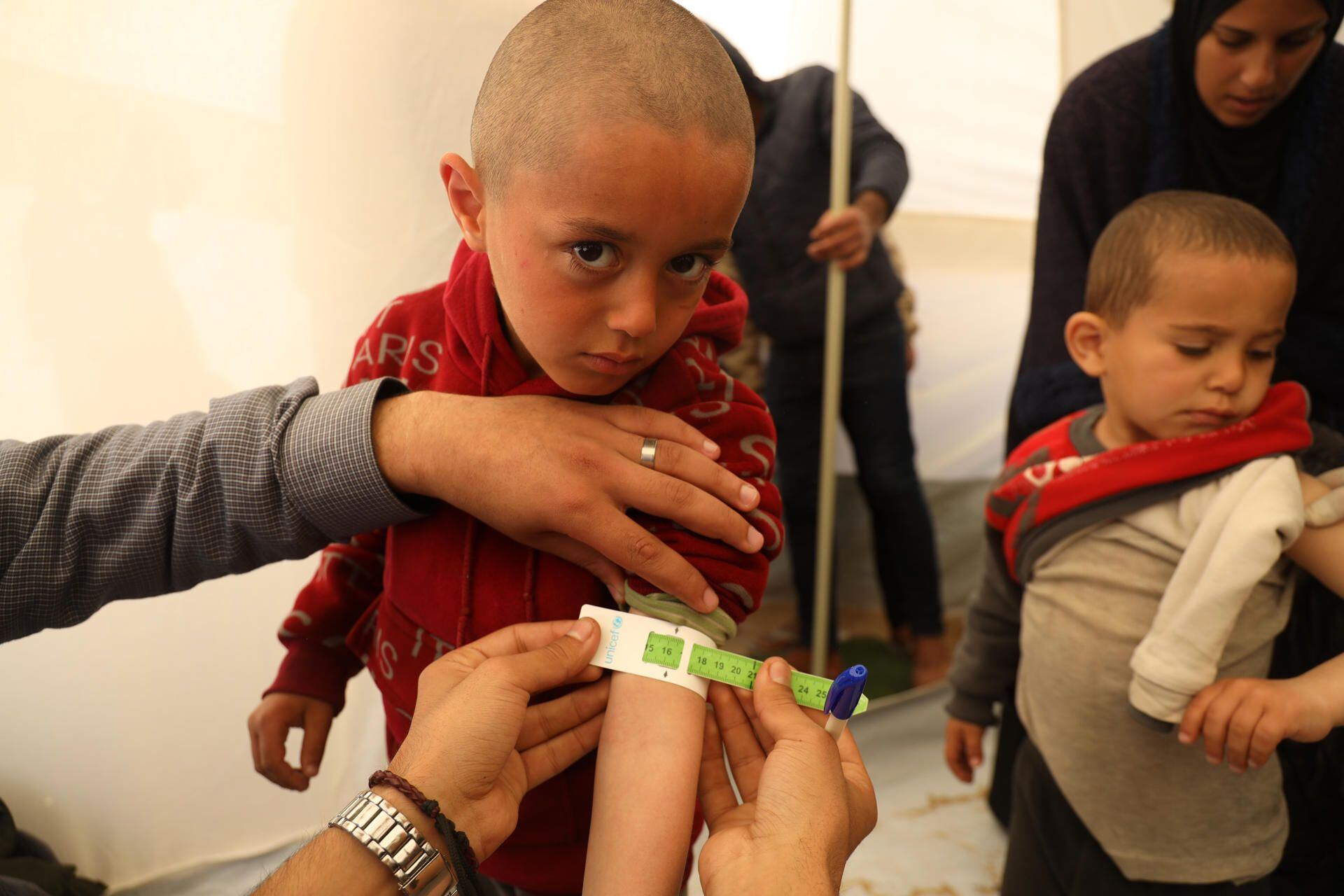 Mohammad, 3, has his upper arm circumference measured as part of his malnutrition screening at a UNICEF-supported pediatric tent in the city of Rafah, in the southern Gaza Strip.  (EFE).