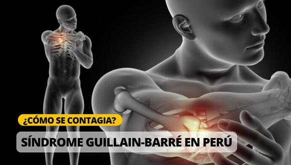 Síntomas y cómo se contrae el síndrome Guillain-Barré | Foto: Diseño EC