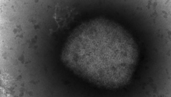 Una imagen de microscopio electrónico muestra el virus de la viruela símica visto por un equipo del Laboratorio de Arbovirus y las Unidades de Genómica y Bioinformática del Instituto de Salud Carlos III (ISCIII) en Madrid.