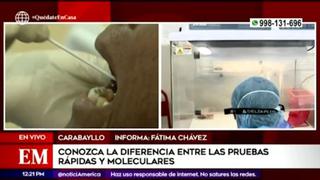 Coronavirus en Perú: estas son las diferencias entre las pruebas rápidas y moleculares 