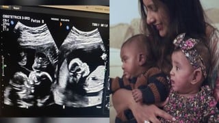 La historia de los gemelos prematuros que cumplen un año de vida y rompen el récord Guinness