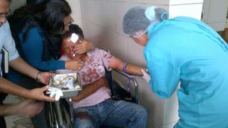 FOTOS: agreden brutalmente a periodista que denunció tráfico de terrenos en Chiclayo