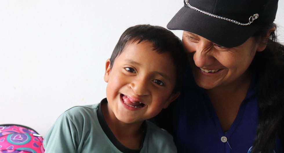 En el Perú, según el Instituto Nacional de Salud del Niño, la incidencia de casos de labio y fisura palatina es aproximadamente 1 por 700 nacidos vivos. (Foto: Operación Sonrisa)
