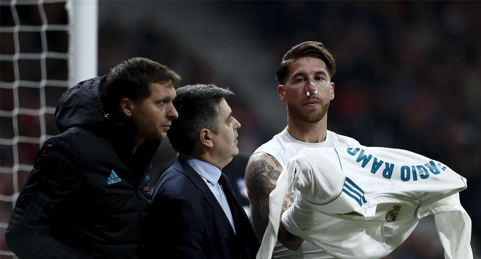 Real Madrid reveló que Sergio Ramos sufre una _\"fractura del hueso propio de la nariz\"_. (Foto: Getty Image)