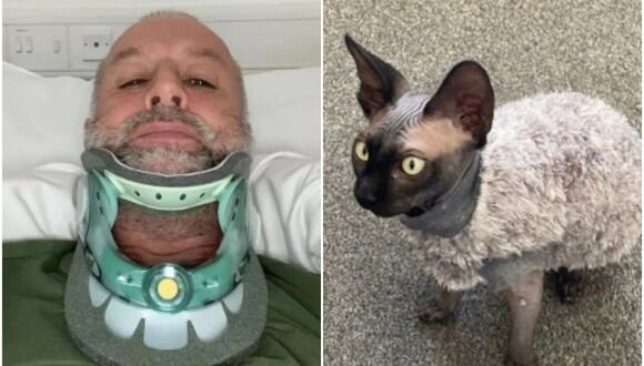 Hombre británico sufre accidente doméstico por culpa de su gato. Sobrevivió, pero terminó con graves heridas. (Foto: ChrisRowley / Facebook)