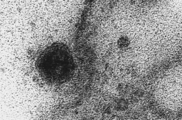 La imagen muestra al SARS-CoV-2 empezando el proceso para infectar el citoplasma de una célula. (Foto: Fiocruz/EFE)