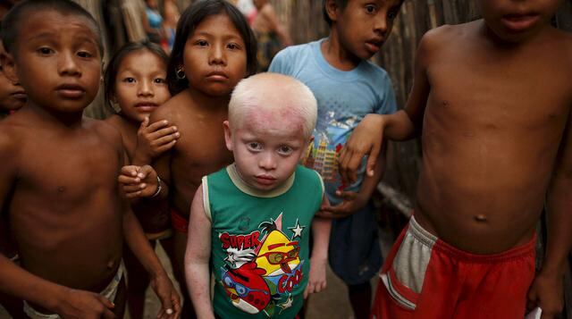 Los indígenas albinos de la etnia Guna que viven en Panamá - 4
