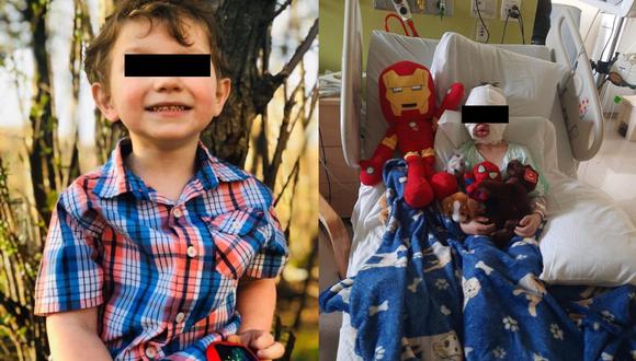 El pequeño Dominick Krankall, de 6 años, sufrió quemaduras de segundo y tercer grado en su rostro y otras partes del cuerpo. (Captura de video / YouTube/WNBC).