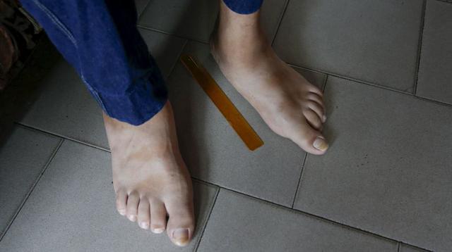 Venezuela: El hombre con los pies más grandes del mundo - 9