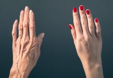 4 razones por las que tus manos se ven avejentadas 