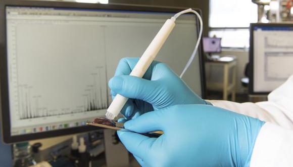 El MasSpec Pen puede analizar de forma no destructiva muestras de tejido humano para identificar el cáncer. (Foto: AP)