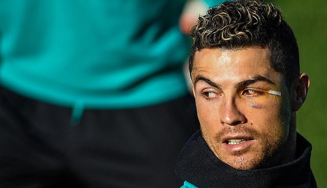 TOPSHOT - Real Madrid's Portuguese forward Cristiano Ronaldo who was injured during a header at last weekend's match attends a training session at Valdebebas sport city in Madrid on January 26, 2018 on the eve of the Spanish League football match against Valencia.  / AFP / OSCAR DEL POZO