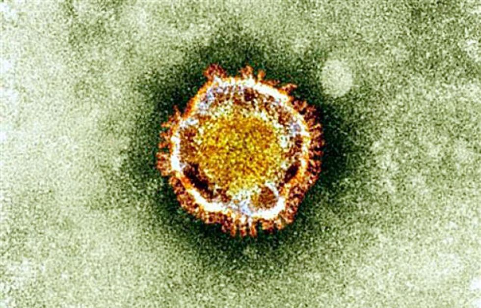 Coronavirus visto bajo un microscopio electrónico. El virus, conocido como nCoV-EMC (nuevo coronavirus) , es un primo del Síndrome Respiratorio Agudo Severo (SRAS) (Foto: AFP/Agencia Británica de Protección de la Salud)