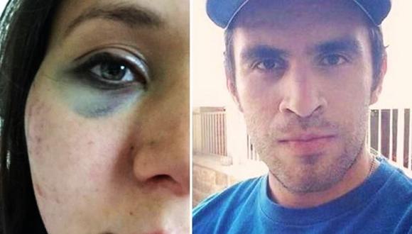 Joven denuncia agresión de su novio a través de Facebook. (Foto: Facebook)