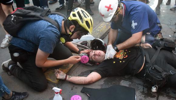Médicos alertan de “emergencia” por heridos oculares en protestas en Chile. Foto: AFP