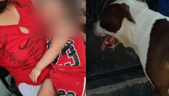 Pitbull agravia y desfigura a niña de dos años en la puerta de su casa. (Foto: TV Perú Noticias)