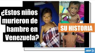 Las historias detrás de las fotos virales con dos niños esqueléticos en Venezuela