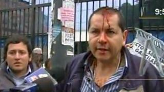 Herido en protesta frente a universidad Garcilaso responsabilizó a rector