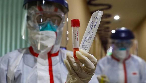 La OMS identificó 168 laboratorios en todo el mundo con la tecnología adecuada para diagnosticar los coronavirus. (AFP)