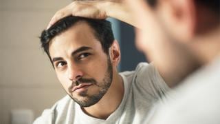 Caída del cabello: cinco consejos para prevenir la calvicie