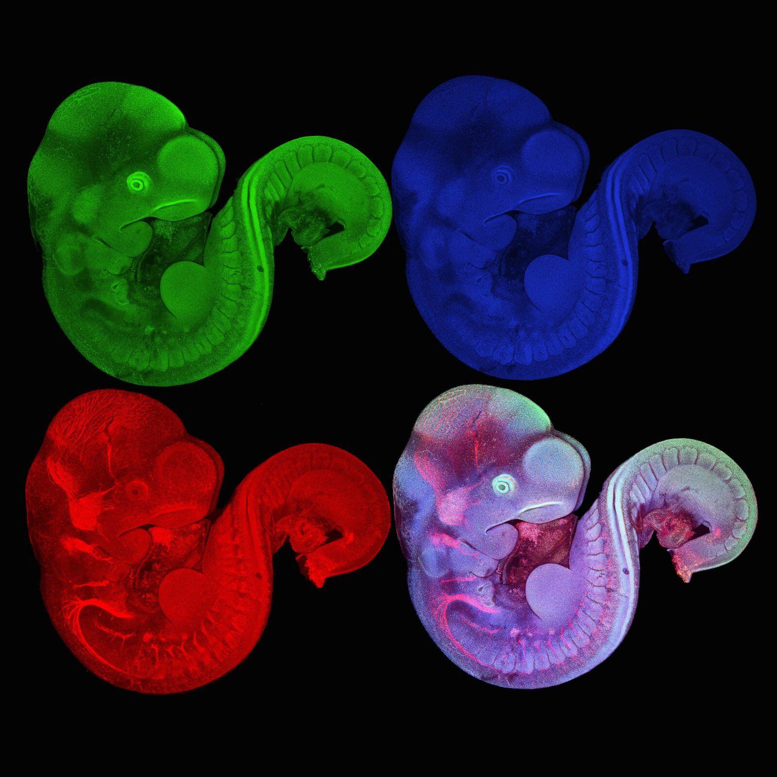 mouse embryo.  (Photo: Nikon Small World/Carlo Donato Caiaffa de Carvalho)