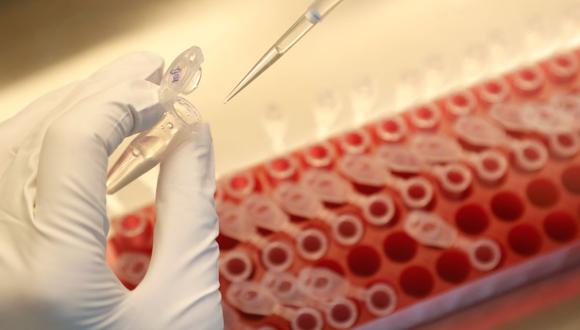 Foto referencial | En la imagen se ve  un laboratorio de muestras diluidas durante la investigación y el desarrollo científico de una vacuna. (Foto: Reuters/Anton Vaganov)