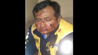 Inspector de la GTU fue brutalmente golpeado tras intervención