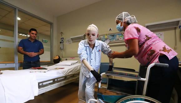 Una historia de resiliencia: Alfredo, de 13 años, ha sido sometido a trece cirugías para curar más de la mitad de su cuerpo (Foto: Alessandro Currarino).