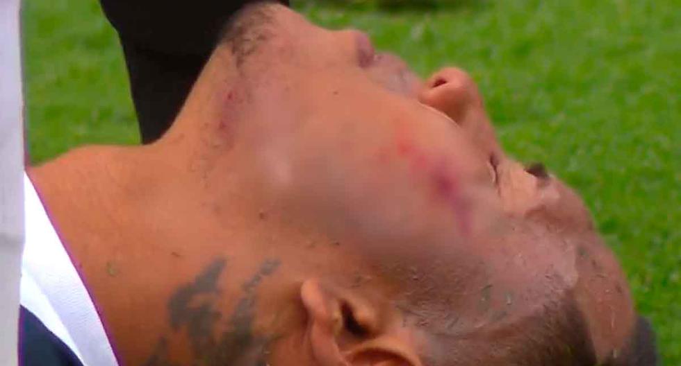 La peligrosa lesión de Bryan Reyna en el Universitario vs. Alianza Lima | VIDEO