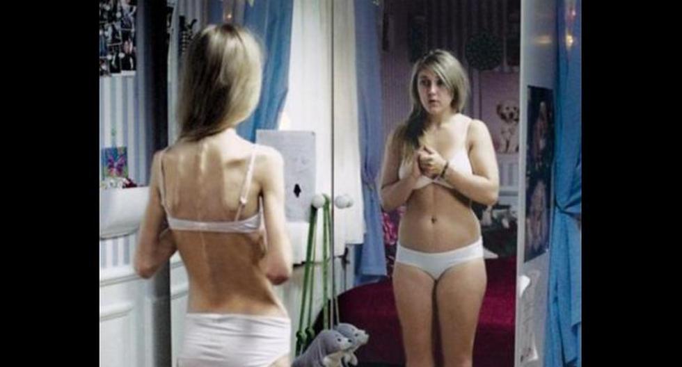 Para evitar anorexia. (Foto: Curiositing.com)