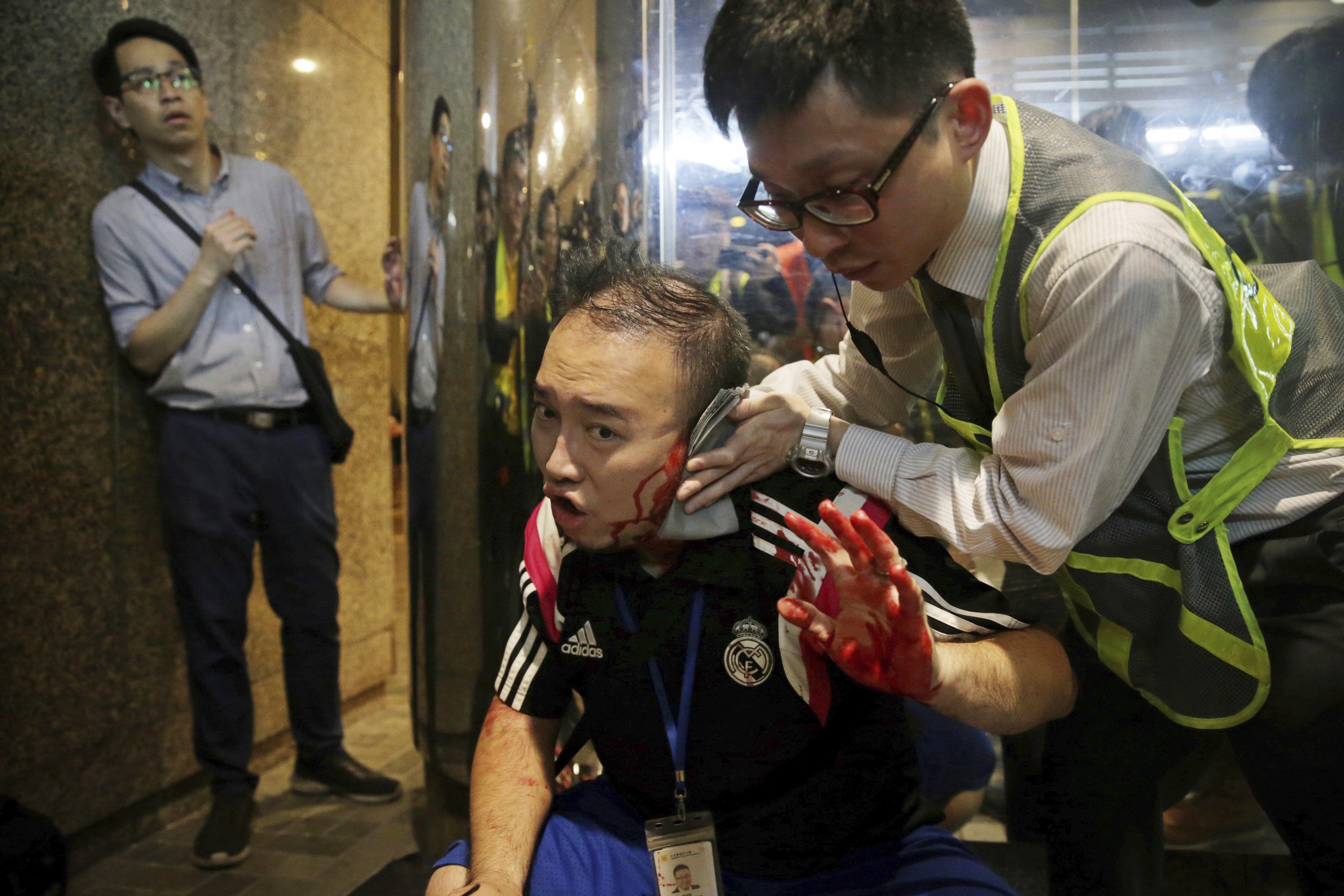 Un hombre mordió parte de la oreja del político local prodemocrático, Andrew Chiu, durante los nuevos disturbios en varios centros comerciales en Hong Kong, (Foto: AP)