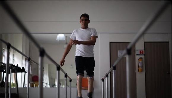 Al principio, con las piernas prostéticas caminaba como robotizado. (FOTO: ESTEBAN VEGA LA-ROTTA)