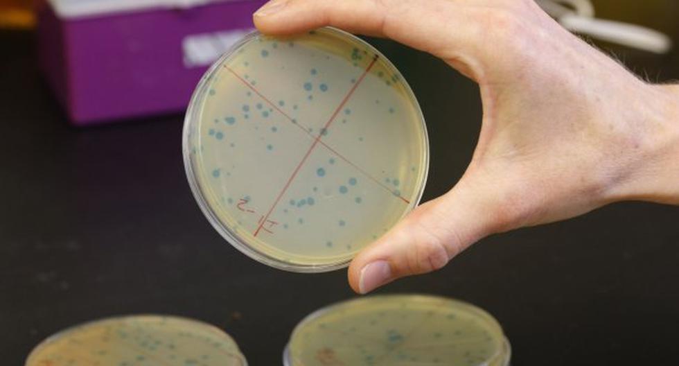 Superbacterias causan preocupación global. (Foto: Andina)