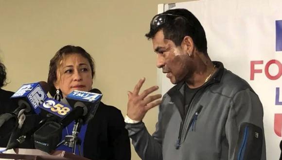Mahud Villalaz explica ante la prensa el ataque que sufrió con ácido en Milwaukee. (Foto: AP).
