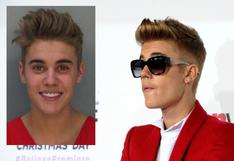 Justin Bieber: Supuesta lesión impide que cumpla su sentencia