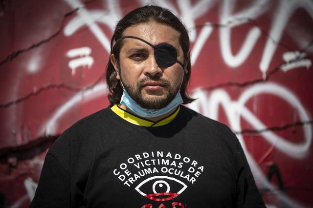 Felipe Riquelme, de 41 años, posa en el lugar donde fue alcanzado en el ojo por un proyectil de gas lacrimógeno disparado por la policía de Chile mientras participaba en una protesta. (Foto de Martin BERNETTI / AFP).