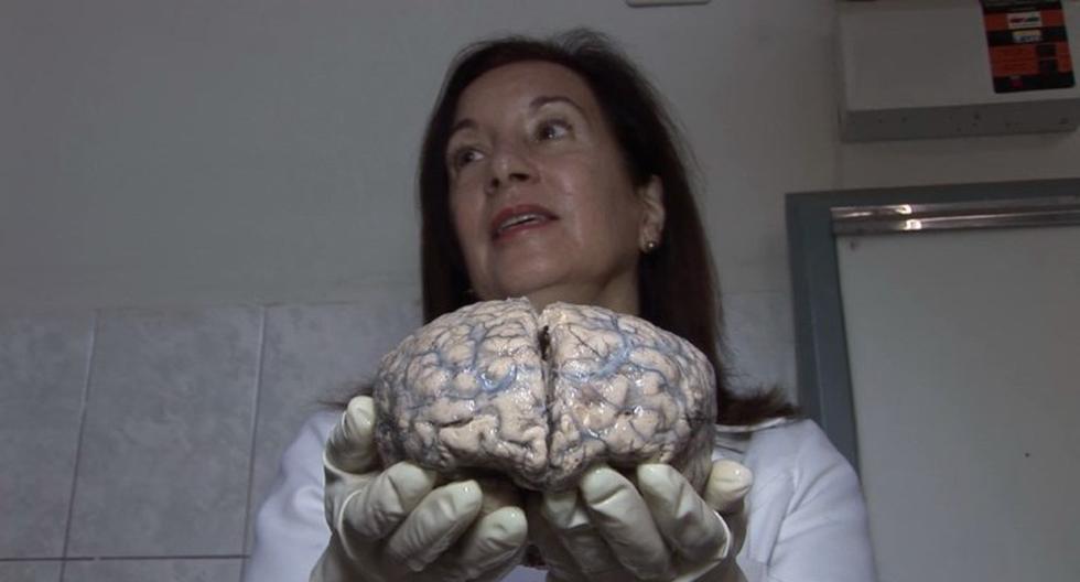 Insólito Museo Invita A Escudriñar El Cerebro Humano Video Tecnologia El Comercio PerÚ 5110