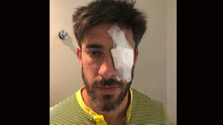 Boca vs. River: así quedó el ojo de Pablo Pérez tras el ataque al bus 'xeneize' | FOTOS