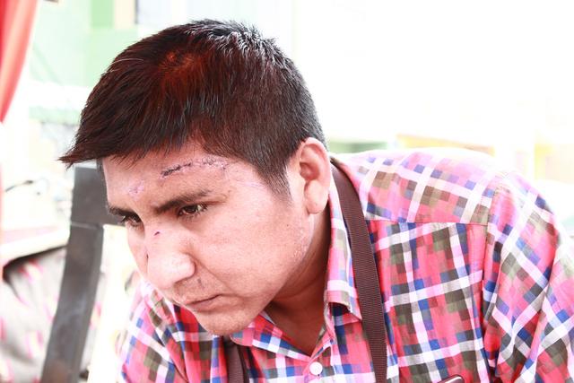 José Halanoca, taxista que frustró violación sexual en Alipio Ponce, pide ayuda a la ciudadanía.
