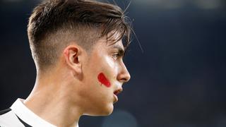 Juventus vs. Napoli: ¿por qué los futbolistas se hicieron esta marca en la cara?